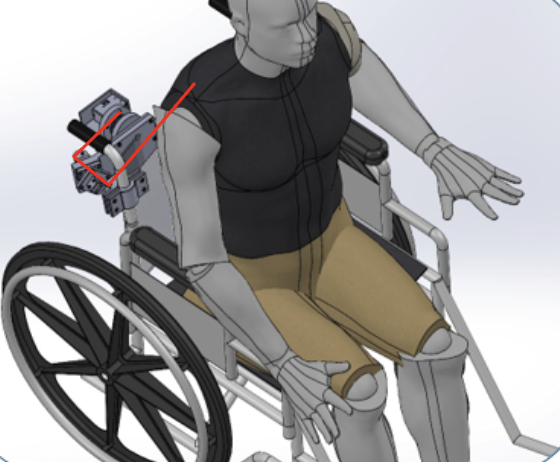 Restoring Postural Control: A Cable-Activated Stabilizing Torso (C.A.S.T) case study preview